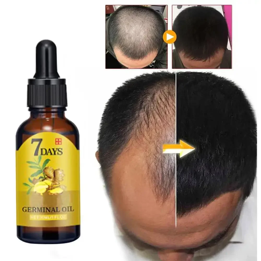 Men'S Grooming Oil - Hair Growth Ginger Fast Growing Hair