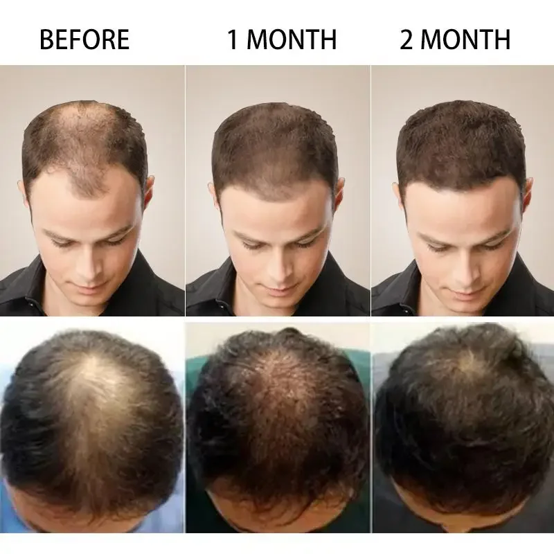 Hair Growth Ginger Fast Growin - Men'S Grooming Oil 评论和价格